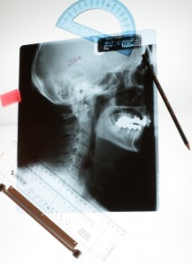 Curves of the spine are measured with precision by Dr Adam Fields