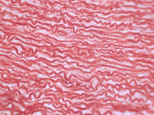 Normal Collagen Fibers