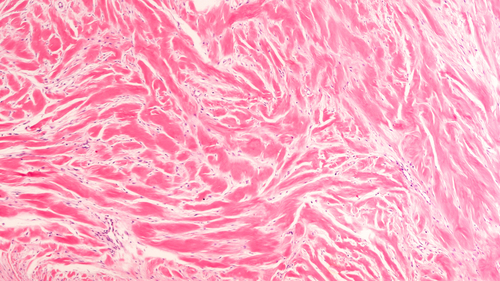 Scar Tissue Fibers