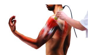 Way beyond cold laser therapy for injury recovery is the Diowave 60 Watt Class IV Laser